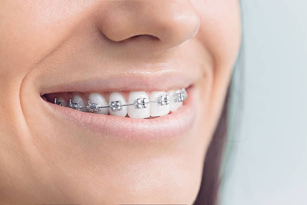 Best Emergency Dental Care  in Ladue, MO